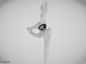 Replaced Hip Implant Modelo 3D