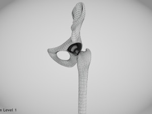 Replaced Hip Implant Modelo 3D