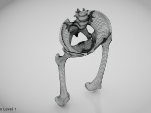 Replaced Hip Implant Modelo 3D
