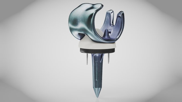 Knee Implant 3D मॉडल .c4d .max .obj .3ds .fbx .stl .blend 