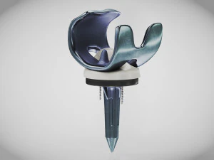 Knie implantaat 3D Model