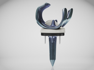 Knee Implant 3D मॉडल