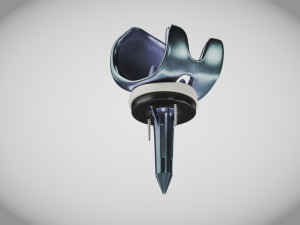 Knee Implant 3D मॉडल