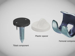 Knie implantaat 3D Model