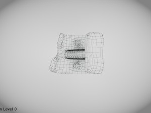 Knee Implant 3D मॉडल