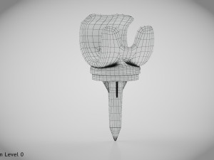 Knee Implant 3D मॉडल