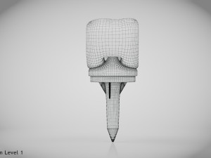 Knee Implant 3D मॉडल