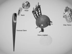 Beckenimplantat 3D Modell