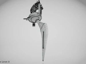 Beckenimplantat 3D Modell