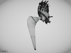Pelvic Implant Modelo 3D