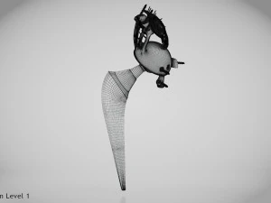 Beckenimplantat 3D Modell