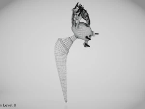 Beckenimplantat 3D Modell