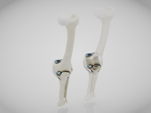 Knee Replacement Implant 3D 模型