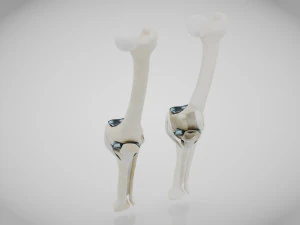 Impianto di sostituzione del ginocchio Modello 3D