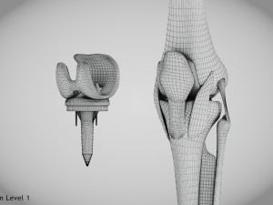 Knee Replacement Implant 3D 模型