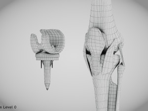 Knee Replacement Implant 3D 模型