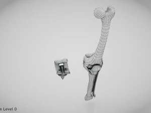 Impianto di sostituzione del ginocchio Modello 3D