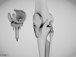 Knee Replacement Implant 3D 模型
