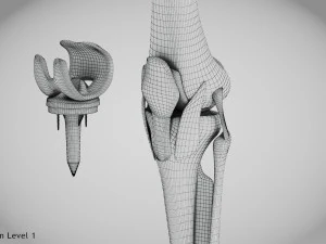 Impianto di sostituzione del ginocchio Modello 3D