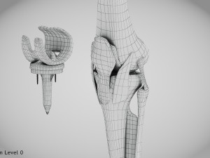 Knee Replacement Implant 3D 模型
