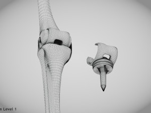 Knee Replacement Implant 3D 模型
