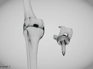 Impianto di sostituzione del ginocchio Modello 3D