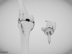 Knee Replacement Implant 3D 模型