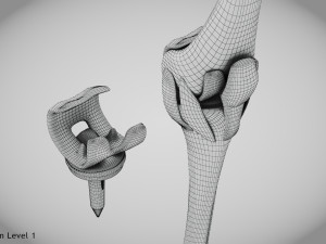 Knee Replacement Implant 3D 模型