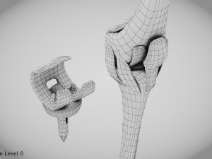 Knee Replacement Implant 3D 模型