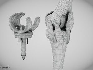 Knee Replacement Implant 3D 模型