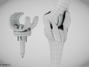 Knee Replacement Implant 3D 模型
