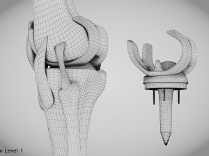 Knee Replacement Implant 3D 模型