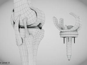 Knee Replacement Implant 3D 模型