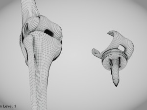 Knee Replacement Implant 3D 模型