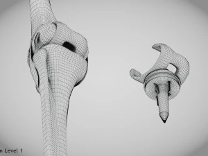 Impianto di sostituzione del ginocchio Modello 3D