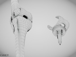 Knee Replacement Implant 3D 模型