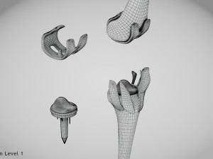 Knee Replacement Implant 3D 模型