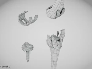 Impianto di sostituzione del ginocchio Modello 3D