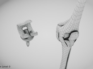 Knee Replacement Implant 3D 模型