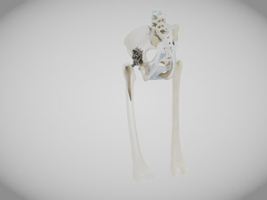 Pelvic Replacement Implant 3D Model