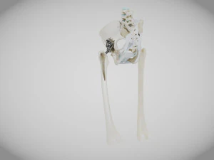 Pelvic Replacement Implant 3D Model