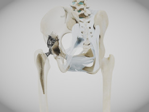 Pelvic Replacement Implant 3D Model