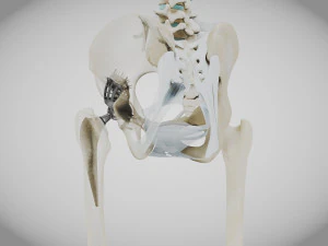 Pelvic Replacement Implant 3D Model