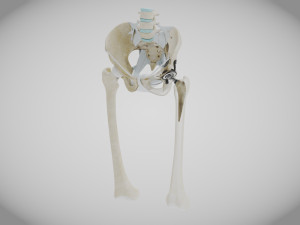 Pelvic Replacement Implant 3D Model