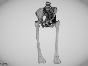 Pelvic Replacement Implant 3D Model