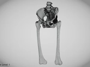 Pelvic Replacement Implant 3D Model
