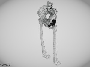 Pelvic Replacement Implant 3D Model