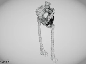 Pelvic Replacement Implant 3D Model