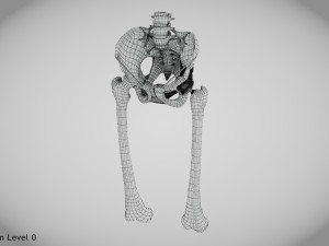 Pelvic Replacement Implant 3D Model