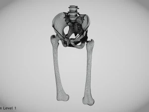 Pelvic Replacement Implant 3D Model